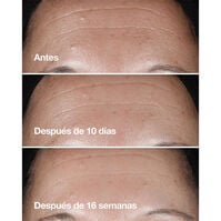 Clinique Smart Clinical Repair Wrinkle Correcting Serum 50ml-200496 Clinique Smart Clinical Repair Wrinkle Correcting Serum 50ml-200496 5